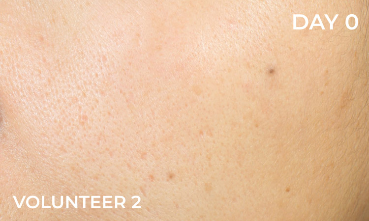 Reduction in dark spots before
